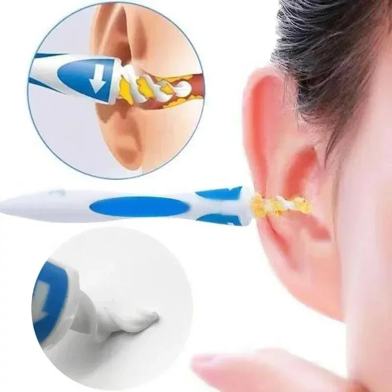 Ear Wax Remover Tool Ear Cleaner With Soft Silicone 16 Replacement Tips - Mobility Buy