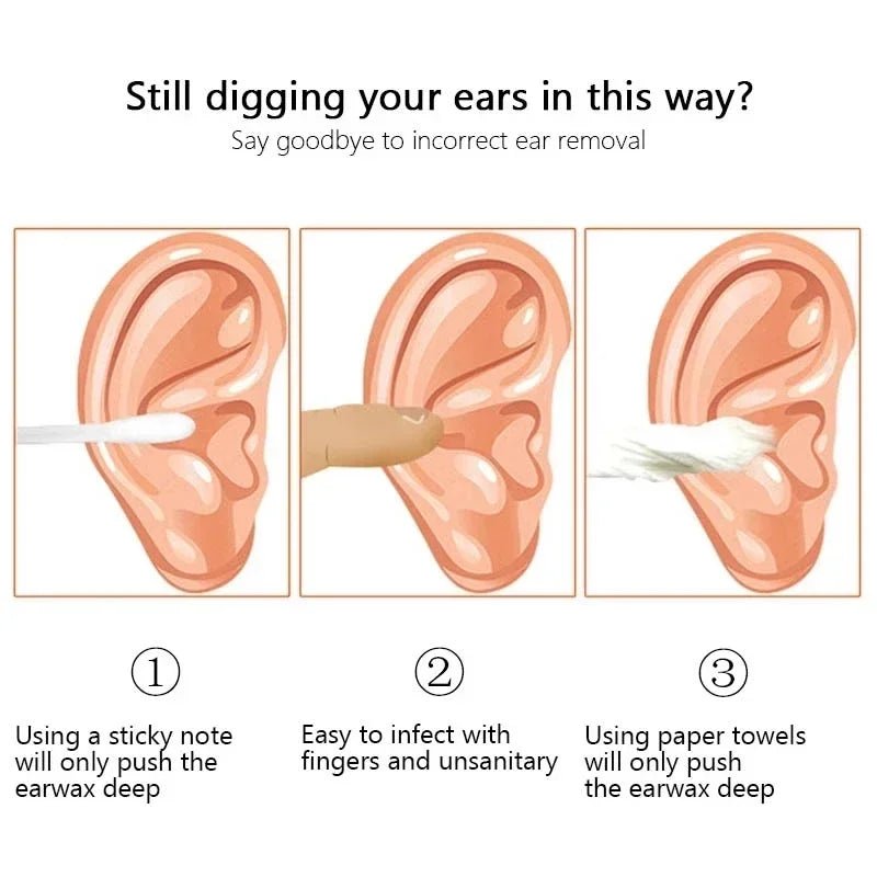 Effective Earwax Cleaning Tool Set - Mobility Buy