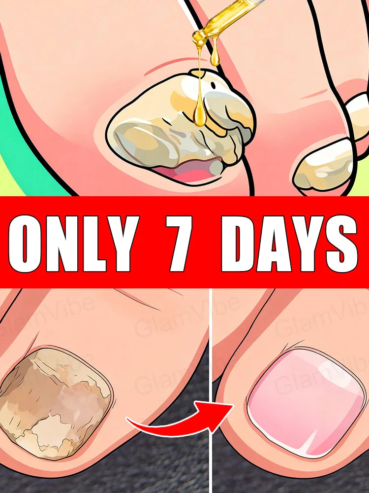 Nail Tʀᴇᴀᴛᴍᴇɴᴛ - Sᴀʏ Gᴏᴏᴅʙʏᴇ ᴛᴏ Fᴜɴɢᴀʟ